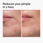 The Ordinary Sulfur 10% Powder-to-Cream Concentrate - Image 7