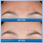 CeraVe Resurfacing Retinol Serum - Image 6