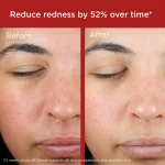 EltaMD UV Skin Recovery Red Color Correcting Green Tint Broad Spectrum SPF 50 - Image 6