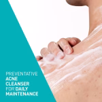 CeraVe Acne Foaming Cream Cleanser - Image 7