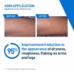 CeraVe Intensive Moisturizing Lotion - Image 5